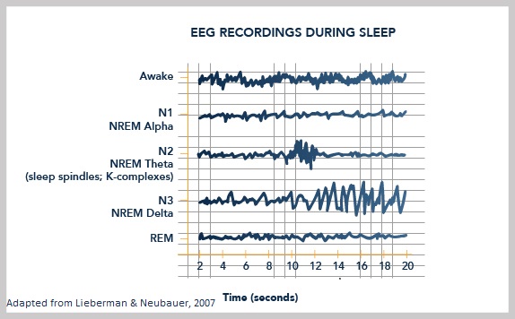 Basics of Sleep - EEG